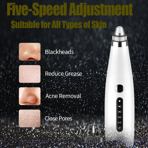 Electric Blackhead Remover