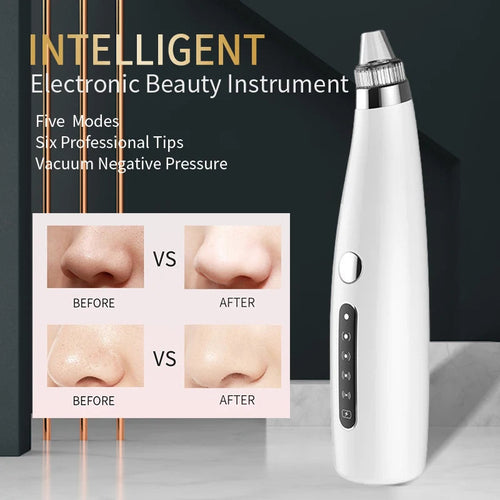 Electric Blackhead Remover