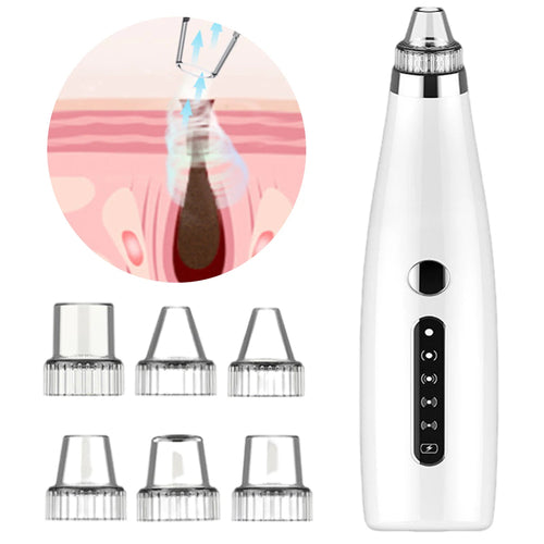 Electric Blackhead Remover